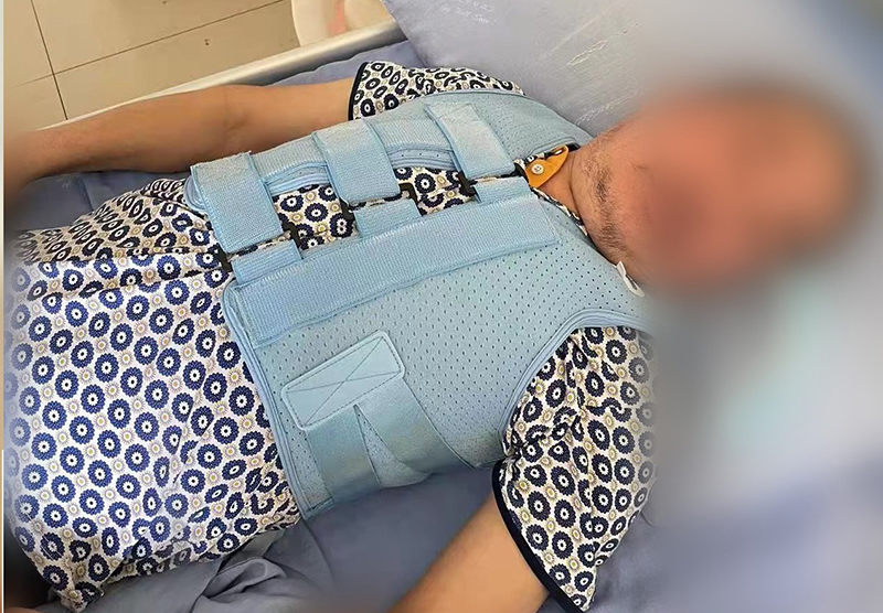 四川資陽骨科醫(yī)院 胸腰椎固定支具